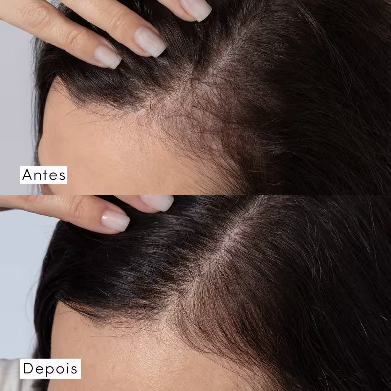 Tônico Concentrado Siàge Dermo Hair Resistência Antiqueda 100ml