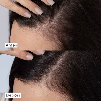 Tônico Concentrado Siàge Dermo Hair Resistência Antiqueda 100ml